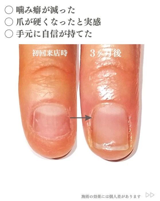 画像291