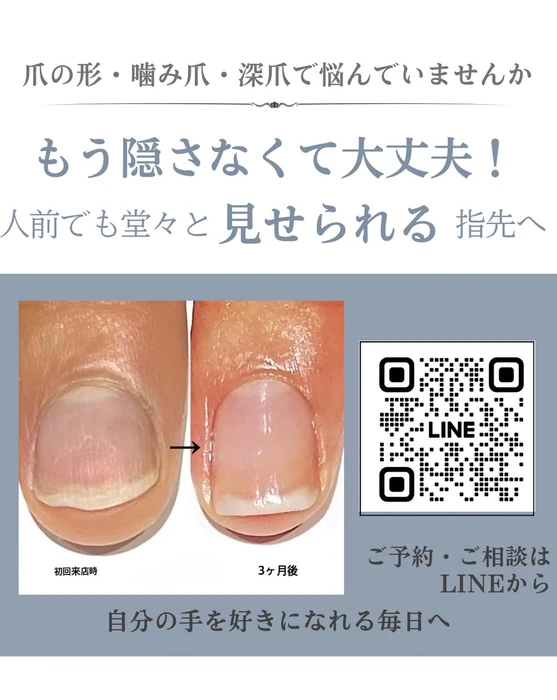 画像293