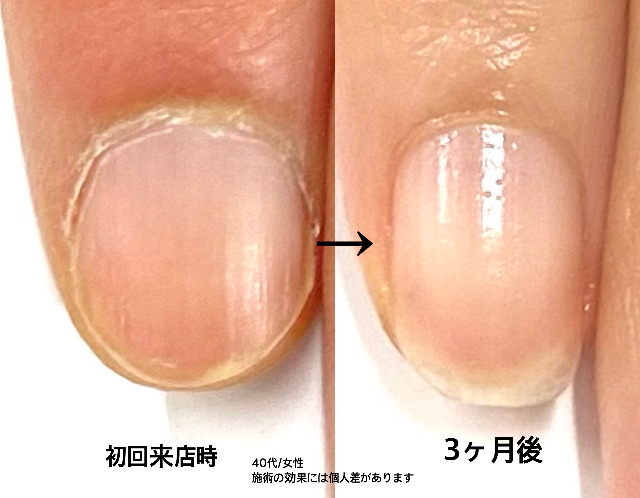 お客様の声・ビフォーアフター